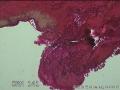 子宫颈内膜组织图1