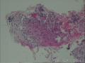食管黏膜图13