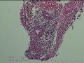 直肠粘膜图7