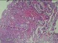 直肠粘膜图26