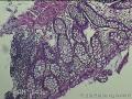 直肠粘膜图3