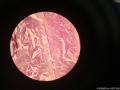 46岁子宫内膜（分泌期？）图7