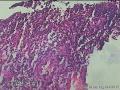 食管粘膜图17