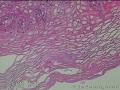 食管中段粘膜图10