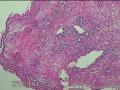 食管中段粘膜图1