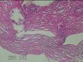 食管中段粘膜图11