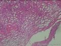食管中段粘膜图6