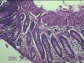 直肠粘膜图21