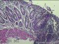 直肠粘膜图17