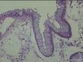 胃角粘膜，图25