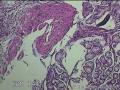 胃窦粘膜图17