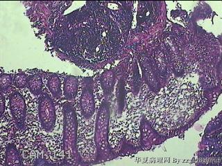 直肠粘膜图2