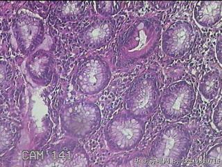 胃窦粘膜图21