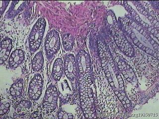 直肠粘膜图13