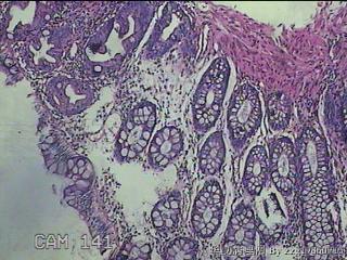 直肠粘膜图12