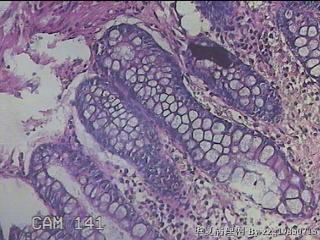 直肠粘膜图30