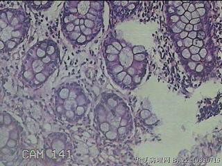 直肠粘膜图28