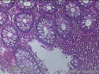 直肠粘膜图16
