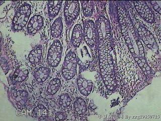 直肠粘膜图7