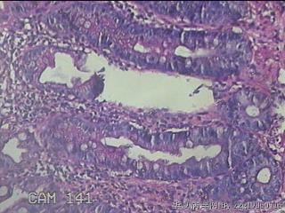 直肠粘膜图24