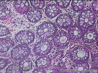 直肠粘膜图14