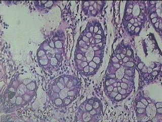 直肠粘膜图27