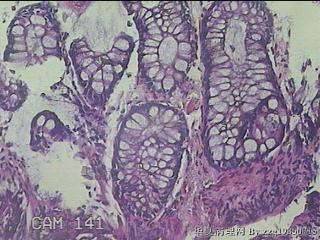直肠粘膜图34