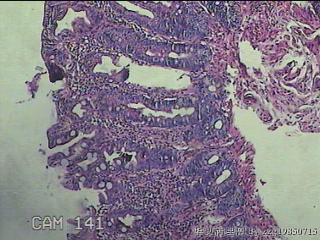 直肠粘膜图11