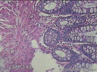 直肠粘膜图38