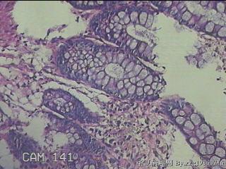 直肠粘膜图31