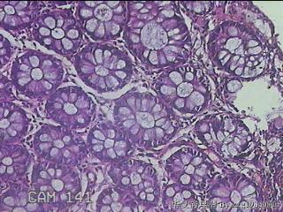 直肠粘膜图21