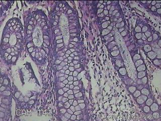 直肠粘膜图29