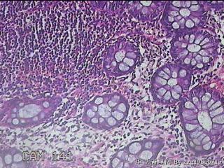直肠粘膜图19