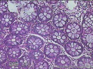 直肠粘膜图22