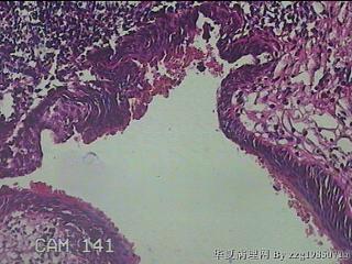 直肠下段粘膜图19