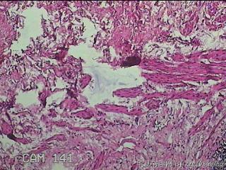 直肠下段粘膜图9