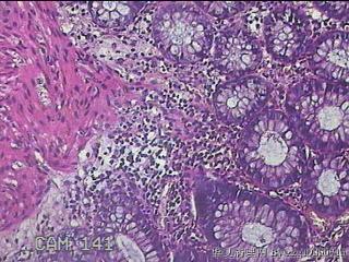 直肠粘膜图32