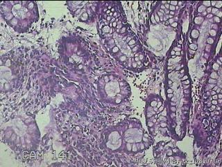 直肠粘膜图48