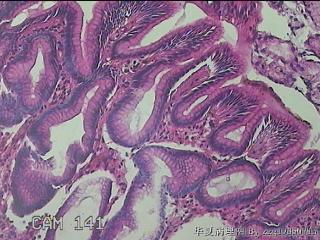 胃窦小弯侧粘膜图13