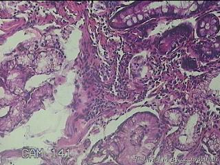 胃窦小弯侧粘膜图24