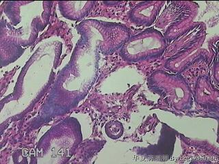 胃窦小弯侧粘膜图19