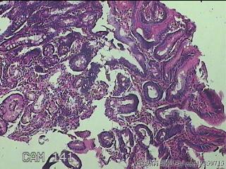 胃窦小弯侧粘膜图1