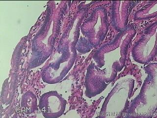 胃窦小弯侧粘膜图12