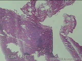 食管粘膜图8