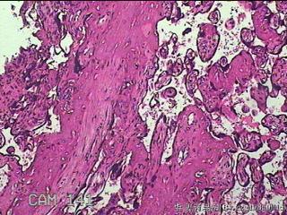 胎盘组织及部分脐带图44