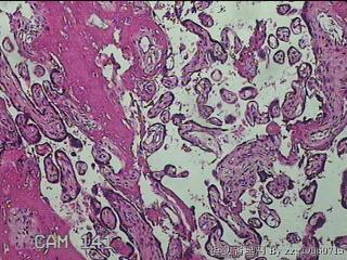 胎盘组织及部分脐带图31