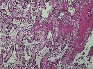 胎盘组织及部分脐带图10