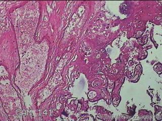 胎盘组织及部分脐带图29