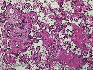 胎盘组织及部分脐带图37
