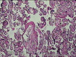 胎盘组织及部分脐带图22